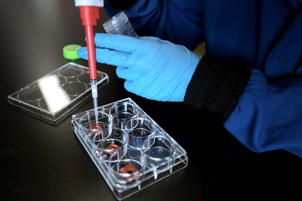 Pipetting hydrogel into molds